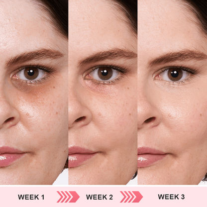 👁️ Seurico™ Retinol Eye Stick – Smooth Away Wrinkles, Puffiness & Dark Circles in Just Weeks!