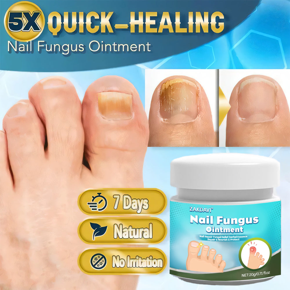 Zakdavi™ 5X Fast Healing Nail Fungus Ointment