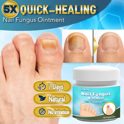 Zakdavi™ 5X Fast Healing Nail Fungus Ointment