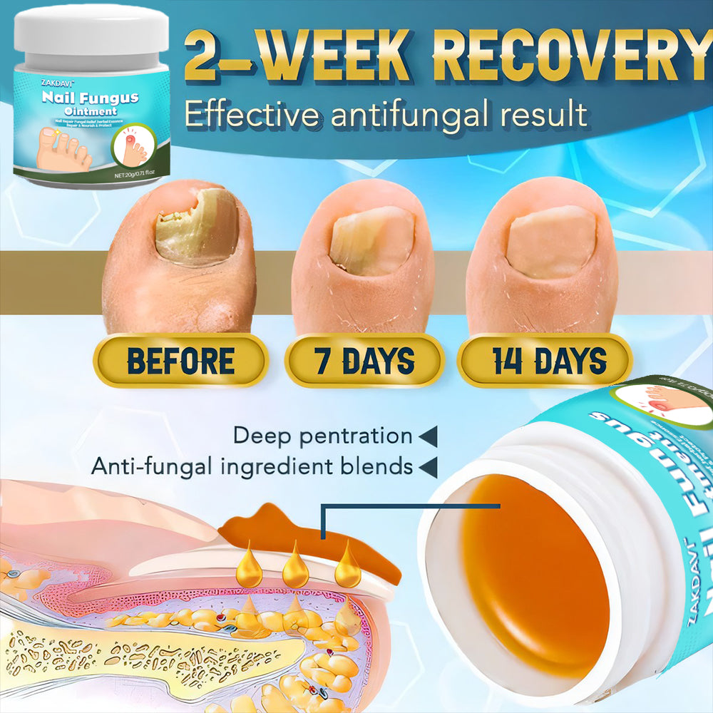 Zakdavi™ 5X Fast Healing Nail Fungus Ointment