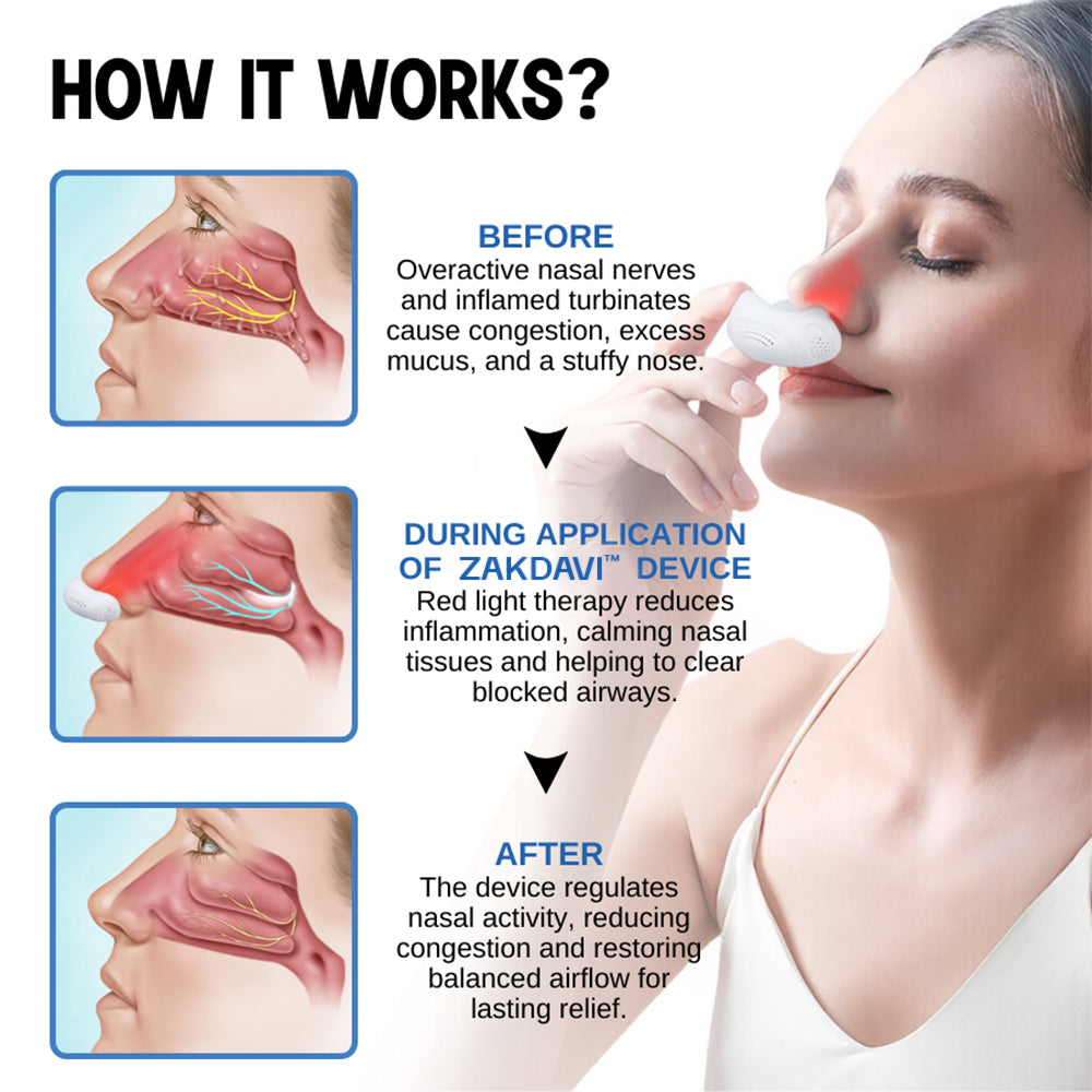 Zakdavi™ Nasal Red Light Therapy Device