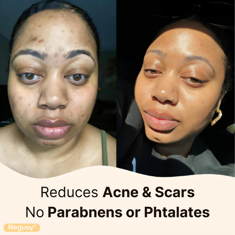 Negusy™ Whipped Beef Tallow & HoneyBalm