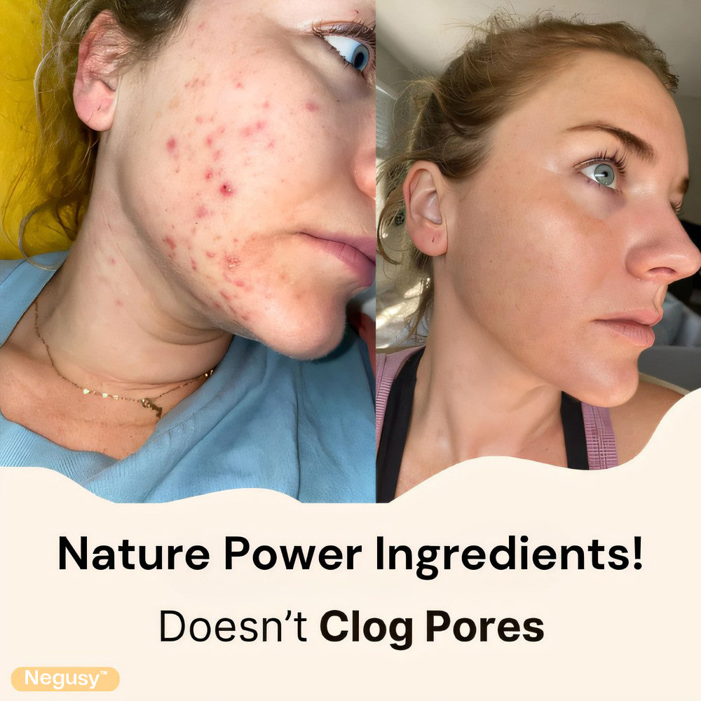 Negusy™ Whipped Beef Tallow & HoneyBalm