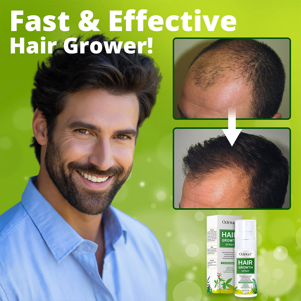 Odeiun™ Nourish & Flourish Hair Growth Spray + 5%Minoxidil