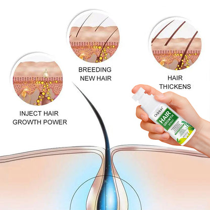 Odeiun™ Nourish & Flourish Hair Growth Spray + 5%Minoxidil