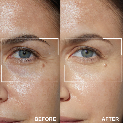 👁️ Seurico™ Retinol Eye Stick – Smooth Away Wrinkles, Puffiness & Dark Circles in Just Weeks!