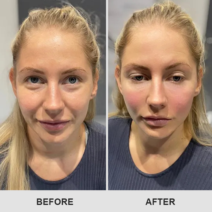 👁️ Seurico™ Retinol Eye Stick – Smooth Away Wrinkles, Puffiness & Dark Circles in Just Weeks!