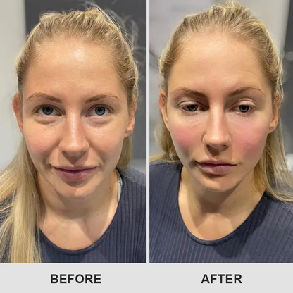 👁️ Seurico™ Retinol Eye Stick – Smooth Away Wrinkles, Puffiness & Dark Circles in Just Weeks!