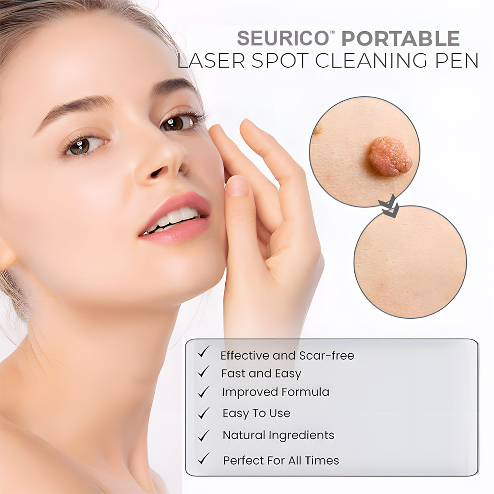 Seurico™ Portable Laser Spot Cleaning Pen