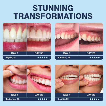 Odeiun™ Bee Venom Gum Repair Powder 🐝 (ADA Approved) 🎁 Flash Sale – Restore Teeth & Gums Now!