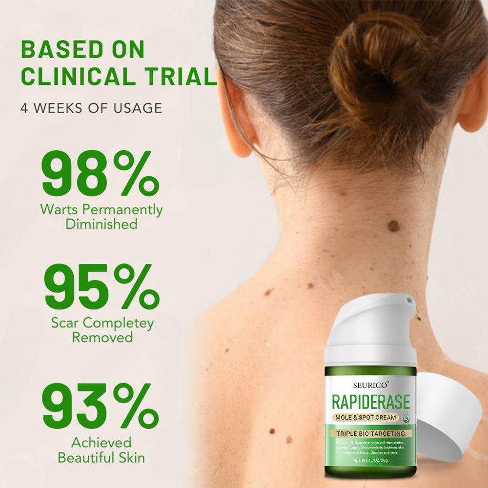 ✅ Official Store: Seurico™ Instant Mole & Spot Cream