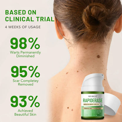 ✅ Official Store: Seurico™ Instant Mole & Spot Cream
