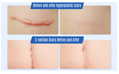 Seurico™ SilkScar Scar Treatment & Skin Repair Serum