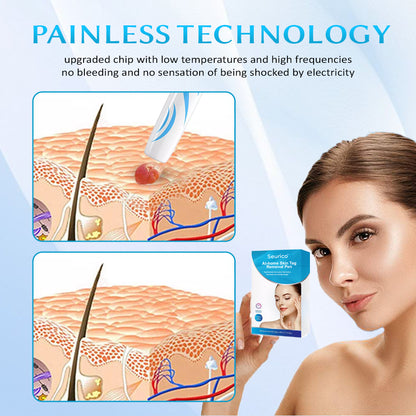 Seurico™ At-home Skin Tag Removal Pen