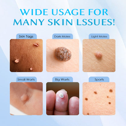Seurico™ At-home Skin Tag Removal Pen