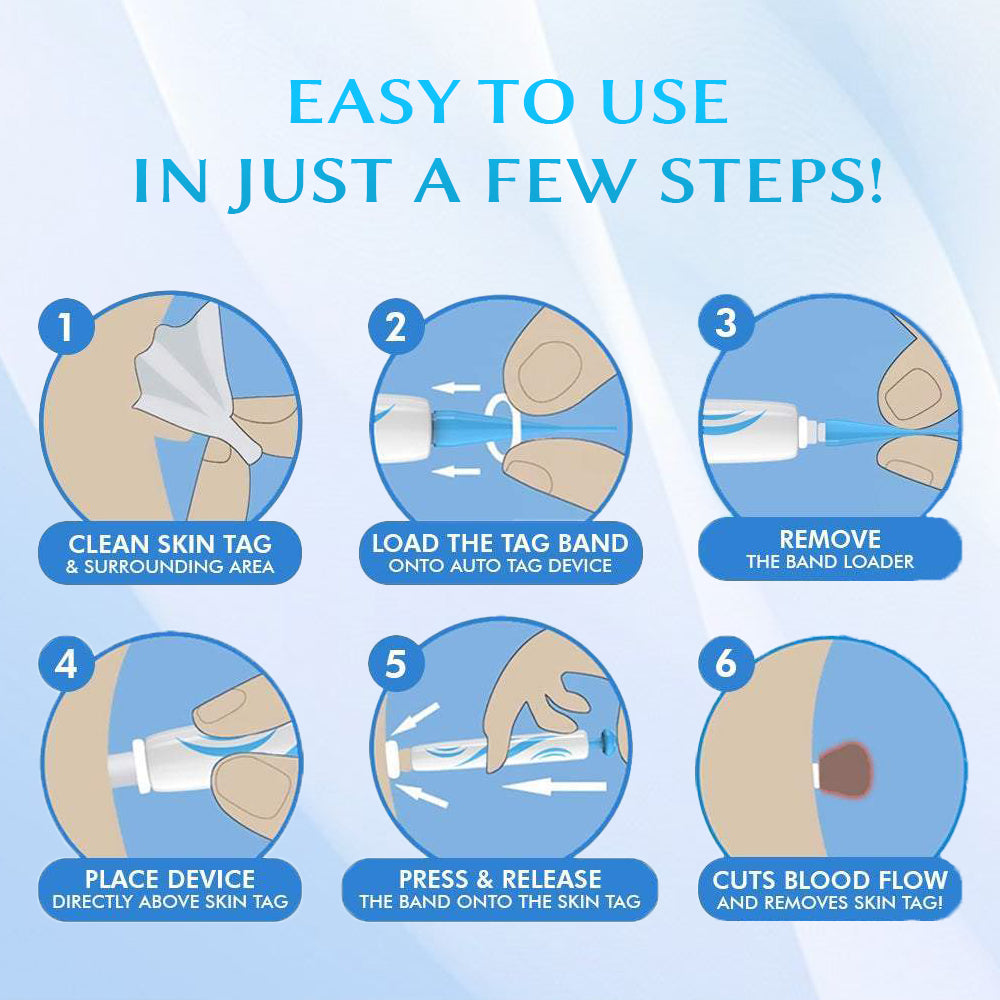 Seurico™ At-home Skin Tag Removal Pen