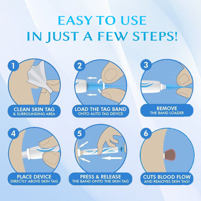 Seurico™ At-home Skin Tag Removal Pen