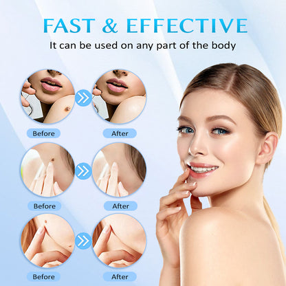 Seurico™ At-home Skin Tag Removal Pen