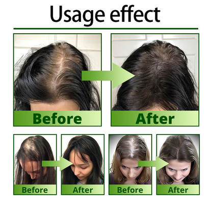 Odeiun™ Nourish & Flourish Hair Growth Spray + 5%Minoxidil