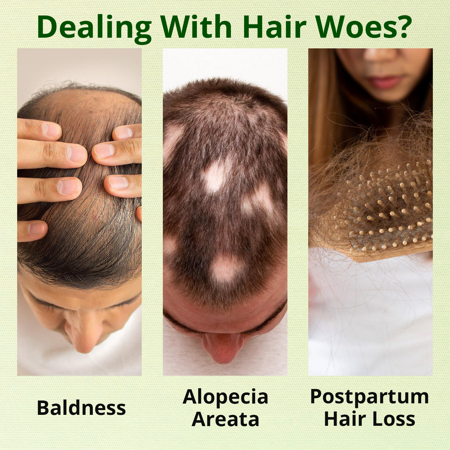 Odeiun™ Nourish & Flourish Hair Growth Spray + 5%Minoxidil