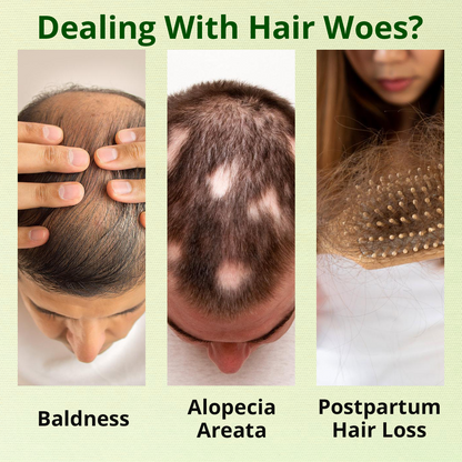 Odeiun™ Nourish & Flourish Hair Growth Spray + 5%Minoxidil