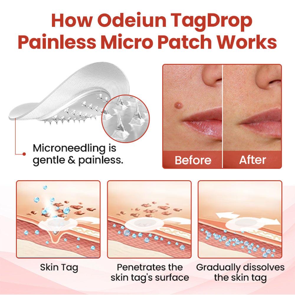 Odeiun™ TagDrop Painless Micro Patch