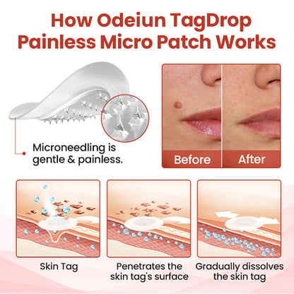 Odeiun™ TagDrop Painless Micro Patch