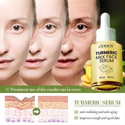 Odeiun™ Turmeric Milk Face Serum - Antioxidant Serum with Sodium Hyaluronate, Niacinamide, and Milk Extract - Anti-Aging & Skin Brightening with Curcuma Longa - 30 ml