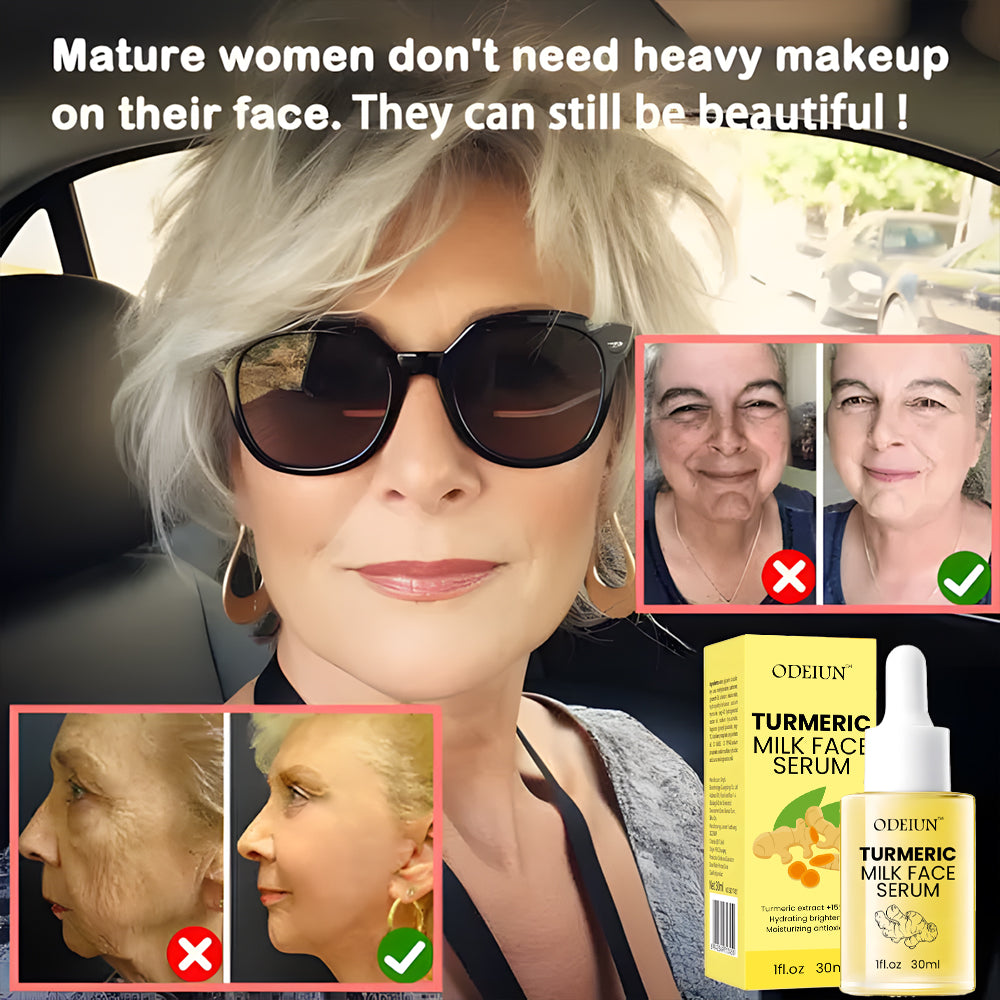 Odeiun™ Turmeric Milk Face Serum - Antioxidant Serum with Sodium Hyaluronate, Niacinamide, and Milk Extract - Anti-Aging & Skin Brightening with Curcuma Longa - 30 ml