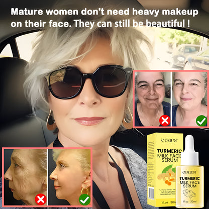 Odeiun™ Turmeric Milk Face Serum - Antioxidant Serum with Sodium Hyaluronate, Niacinamide, and Milk Extract - Anti-Aging & Skin Brightening with Curcuma Longa - 30 ml