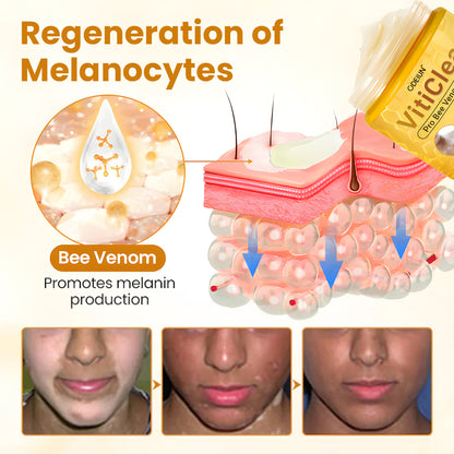 ODEIUN™ VitiClear Pro Bee Venom Cream – Targeted Care for Even-Toned Skin