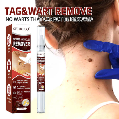 Seurico™ WipeOff Tags & Mole Remover