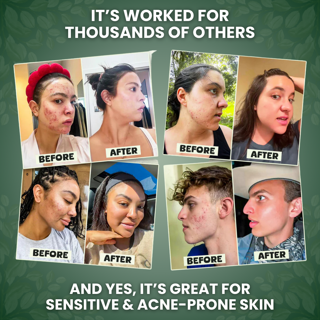 Beef Tallow & Honey Balm