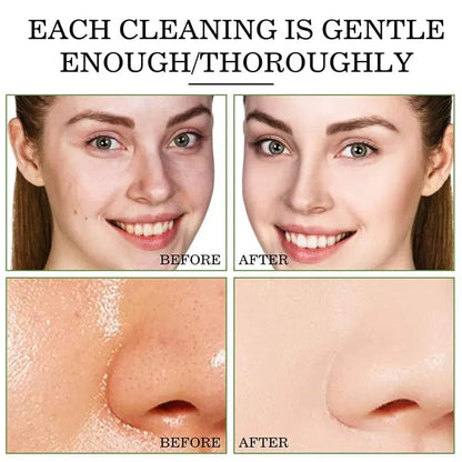 Zakdavi™ Detoxifying Green Tea Face Mask Stick