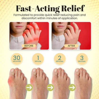 Bee Venom Professional Care Gel (Fast-Acting Bee Venom Therapy for Joint & Muscle Relief)