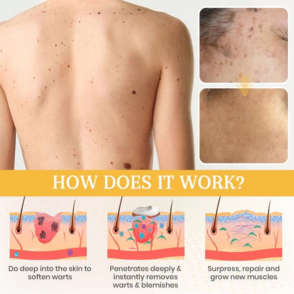 Seurico™ New NatureVanish Instant Mole & Spot Removal Gel