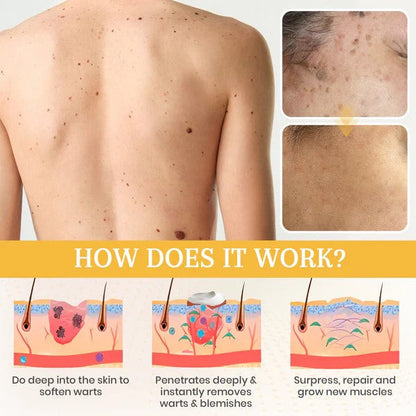 Seurico™ New NatureVanish Instant Mole & Spot Removal Gel