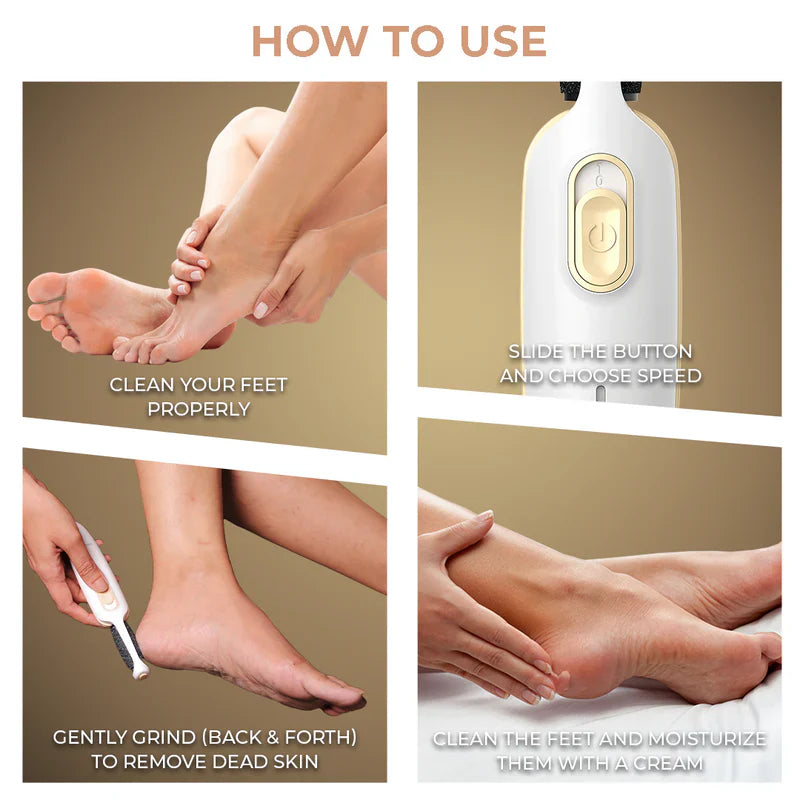 Seurico™Foot roller to remove calluses