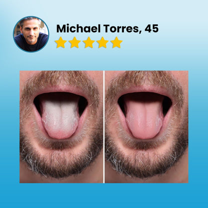 ✨ LBMLBM® Tongue Detox Gel | The Secret to Lasting Fresh Breath