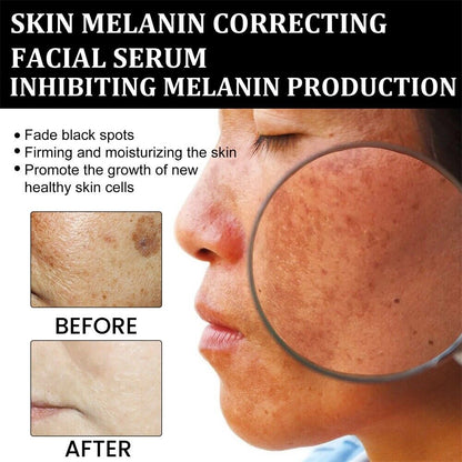 Seurico™ Melanin Correcting Facial Serum