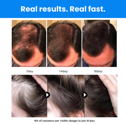 Odeiun™ Botanical Hair Growth Serum with Roll-On Applicator