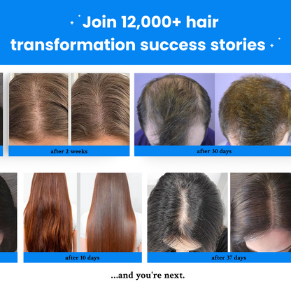 Odeiun™ Botanical Hair Growth Serum with Roll-On Applicator