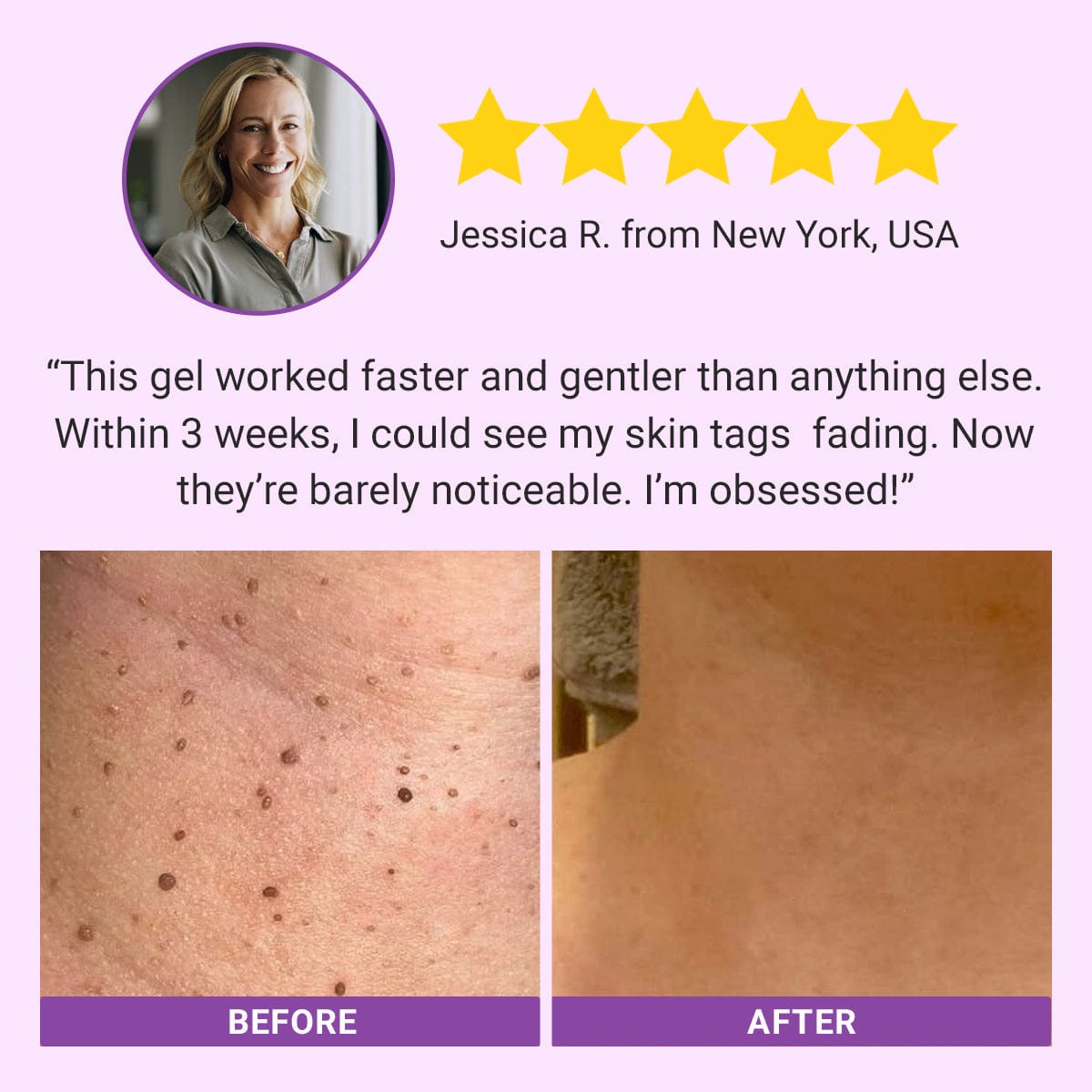 Seurico™ DermaClear Mole and Dark Spot Removal Bio-Gel