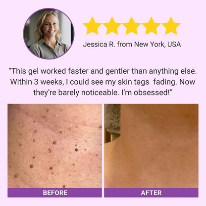 Seurico™ DermaClear Mole and Dark Spot Removal Bio-Gel